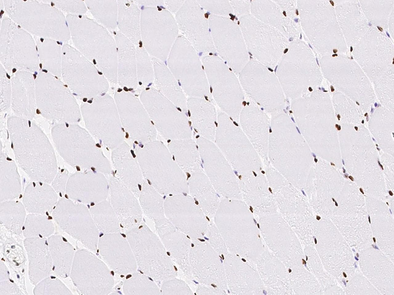 MEF2D Antibody