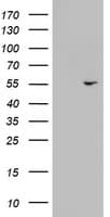 Monoclonal Mouse anti-Human KRT24 / Keratin 24 Antibody (clone OTI3F10, aa139-397, WB)