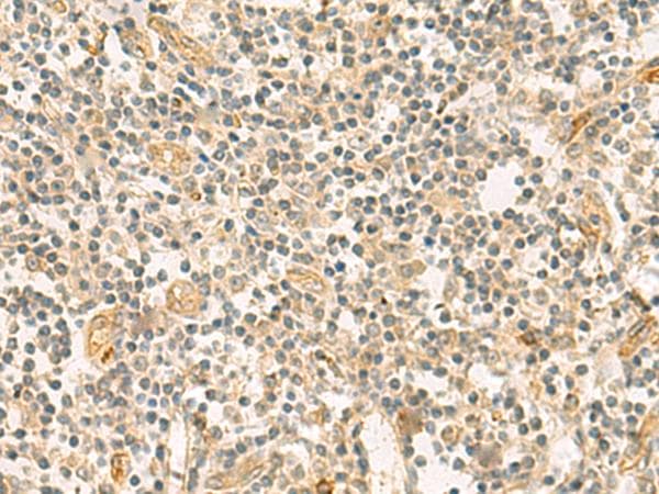 HHIPL2 Antibody