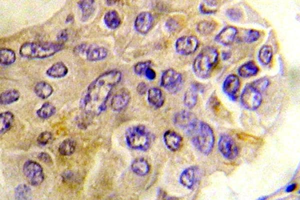 PRKD1 / PKC Mu Antibody (phospho-Ser738)