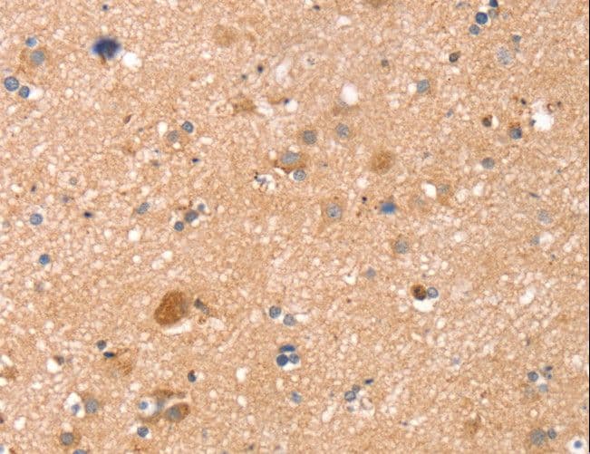 TMSB10 / Thymosin Beta 10 Antibody