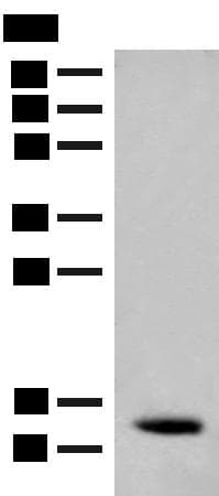 AKAP7 Antibody