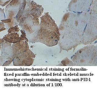 Polyclonal Rabbit anti-Human PID1 Antibody (aa83-250, IHC, WB)