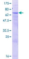 Human SPOPL Protein (Recombinant GST)
