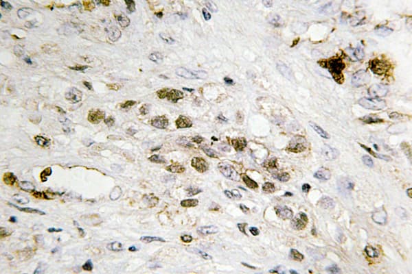 Polyclonal Rabbit anti-Human FOXC1+2 Antibody (Lys138, IHC, IF, WB)