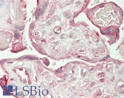 IHC-plus™ JMY Antibody (aa1-50)