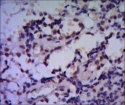 HSPA4 / APG-2 Antibody (clone 5A6)