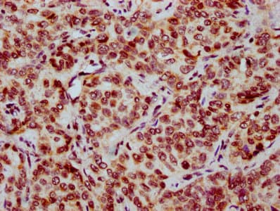 HIST1H2BN Antibody