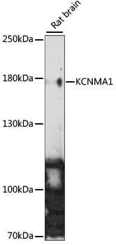 Polyclonal Rabbit anti-Human KCNMA1 / BK Antibody (WB)