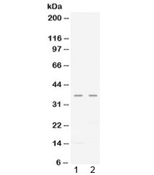 Polyclonal Rabbit anti-Human CXCL16 Antibody (WB)
