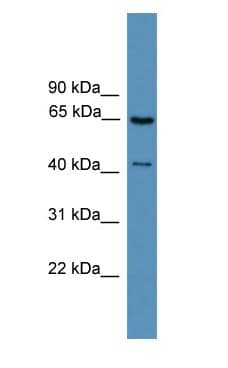 Rhodopsin Kinase / GRK1 Antibody (aa401-450)