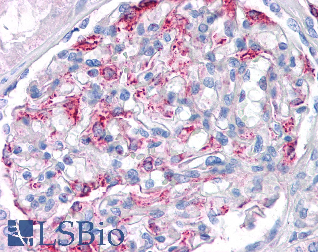 IHC-plus™ MATN1 / Matrilin 1 Antibody