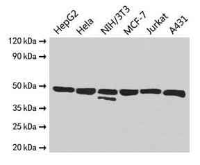 Polyclonal Rabbit anti-Human ENO1 / Alpha Enolase Antibody (IHC, WB)