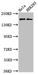 Polyclonal Rabbit anti-Human KIDINS220 / ARMS Antibody (IHC, IF, WB)