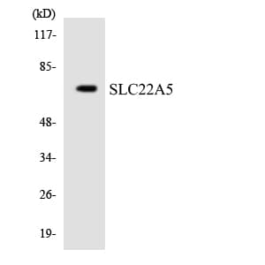 IHC-plus™ Polyclonal Rabbit anti-Human SLC22A5 / OCTN2 Antibody (aa282-331, IHC, WB)