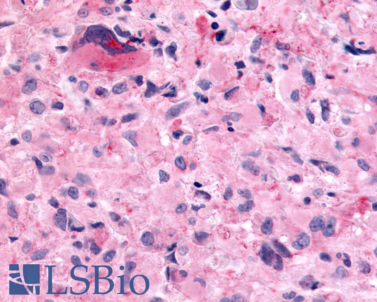 PathPlus™ Polyclonal Rabbit anti-Human GPR182 / ADMR Antibody (N-Terminus, IHC, WB)