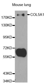 COL5A1 / Collagen V Alpha 1 Antibody