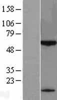 KLHDC7B Protein (Over-Expression Lysate Myc-DDK (Flag))