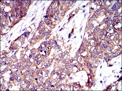 TWF1 / PTK9 Antibody (clone 7C11)