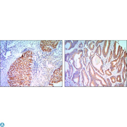 KLHL11 Antibody