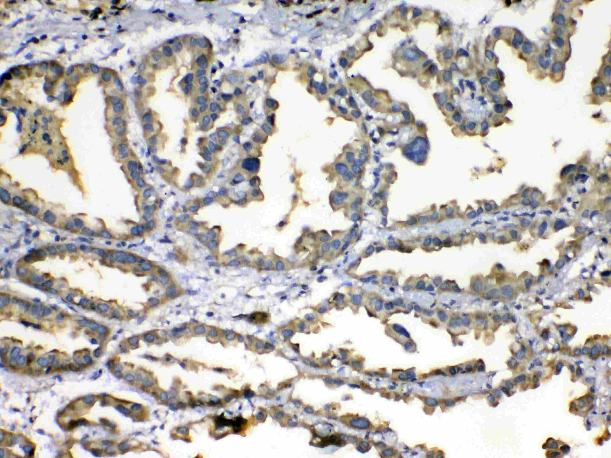 SOD3 Antibody