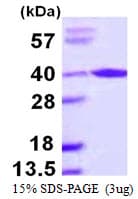 Human ARA9 / AIP Protein (Recombinant His)