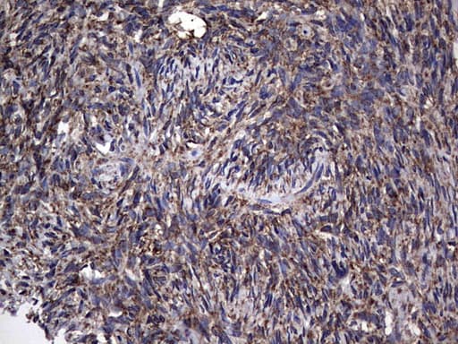 MTDH / Metadherin Antibody (aa70-582, clone OTI1B6)