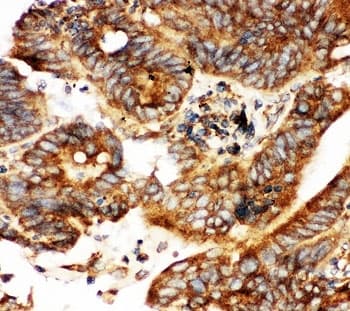 CALB1 / Calbindin Antibody (aa2-175)