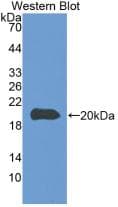 CASP8 / Caspase 8 Antibody (aa25-175, Cy3)
