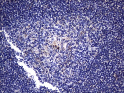 CRP / C-Reactive Protein Antibody (clone OTI1G10)