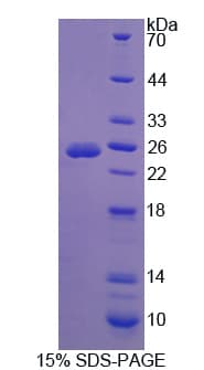 Human ATXN10 / SCA10 Protein (Recombinant His-T7)