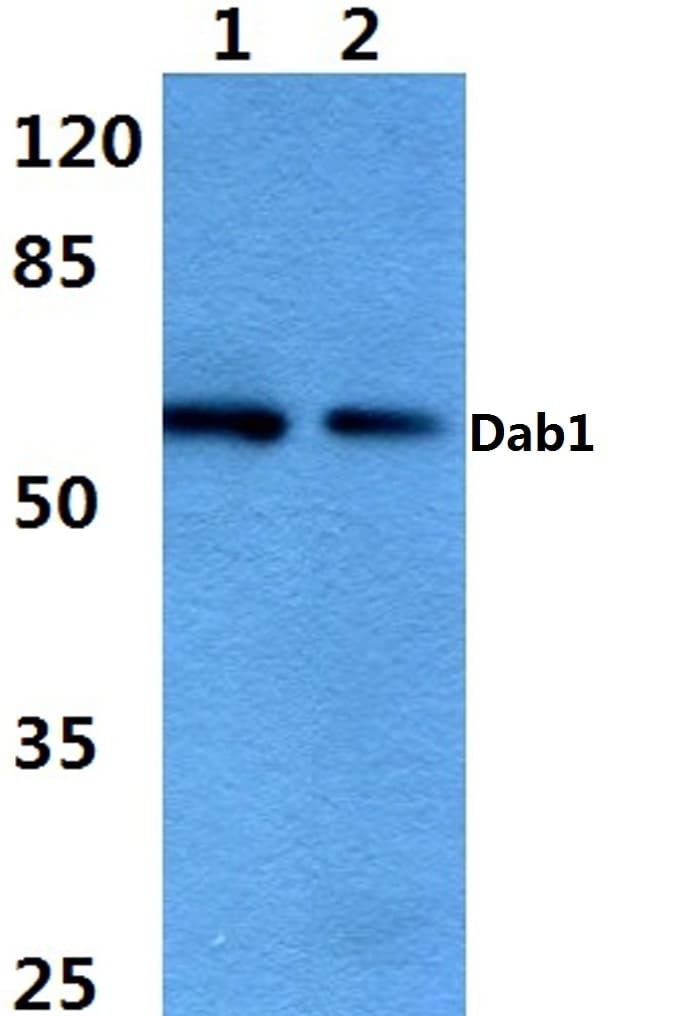 IHC-plus™ DAB1 Antibody (aa191-240)