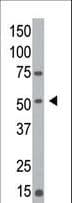 MGAT / GLYT1 Antibody (C-Terminus)