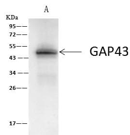 Polyclonal Rabbit anti-Human GAP43 Antibody (Preservative Free, IHC, WB)