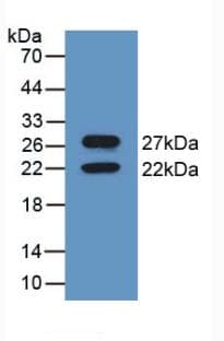 CANX / Calnexin Antibody (aa263-482)