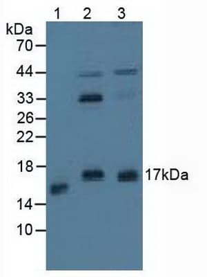 PPP3R1 / Calcineurin B Antibody (aa2-170, PE)