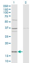 FAU / Fub1 Antibody (clone 3C10)