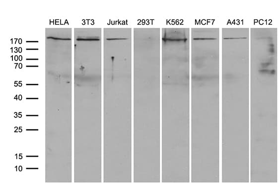 ARHGAP5 / RhoGAP5 Antibody (aa948-1261, clone OTI9H2)