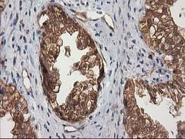 DSTN / Destrin Antibody (clone OTI2C10)