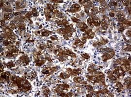 NME1 / NM23 Antibody (clone OTI7F6)