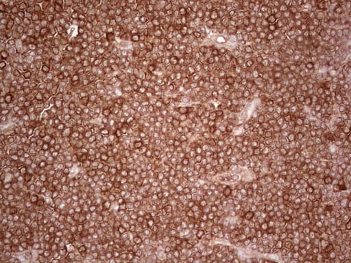 PKM2 Antibody (clone OTI11G10, Carrier-free)