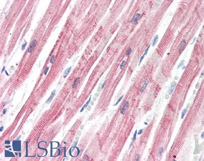 Polyclonal Rabbit anti-Human FHL2 Antibody (IHC, WB)