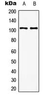 GRM8 / MGLUR8 Antibody (C-Terminus)