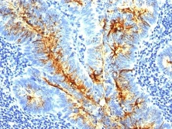 Monoclonal Mouse anti-Human TAG-72 Antibody (clone SPM536, IHC, IF)
