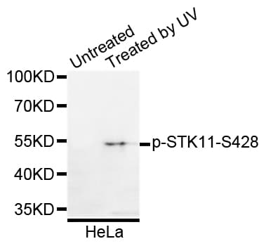 STK11 / LKB1 Antibody (phospho-Ser428)