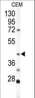 KRT19 / CK19 / Cytokeratin 19 Antibody (aa336-365)