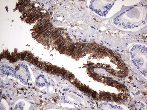 LGALS3 / Galectin 3 Antibody (clone OTI1C7)