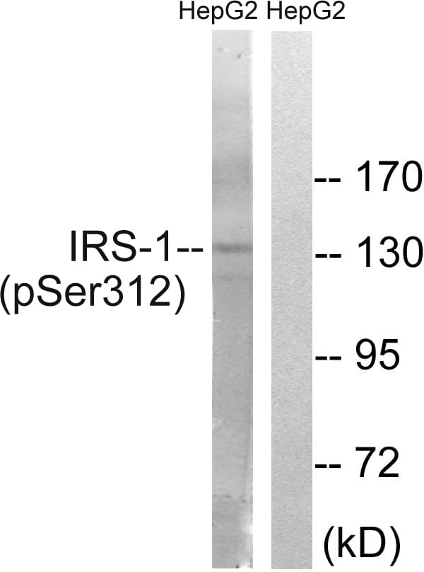 IRS1 Antibody (phospho-Ser312)