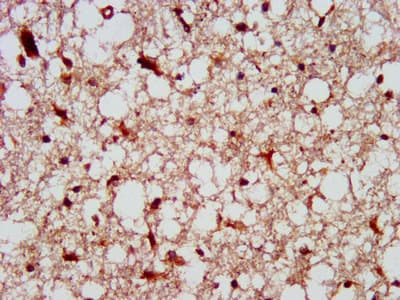 Polyclonal Rabbit anti-Human FAP-1 / PTPN13 Antibody (IHC, IF)