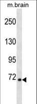 RPS6KA1 / RSK1 Antibody (aa556-583)